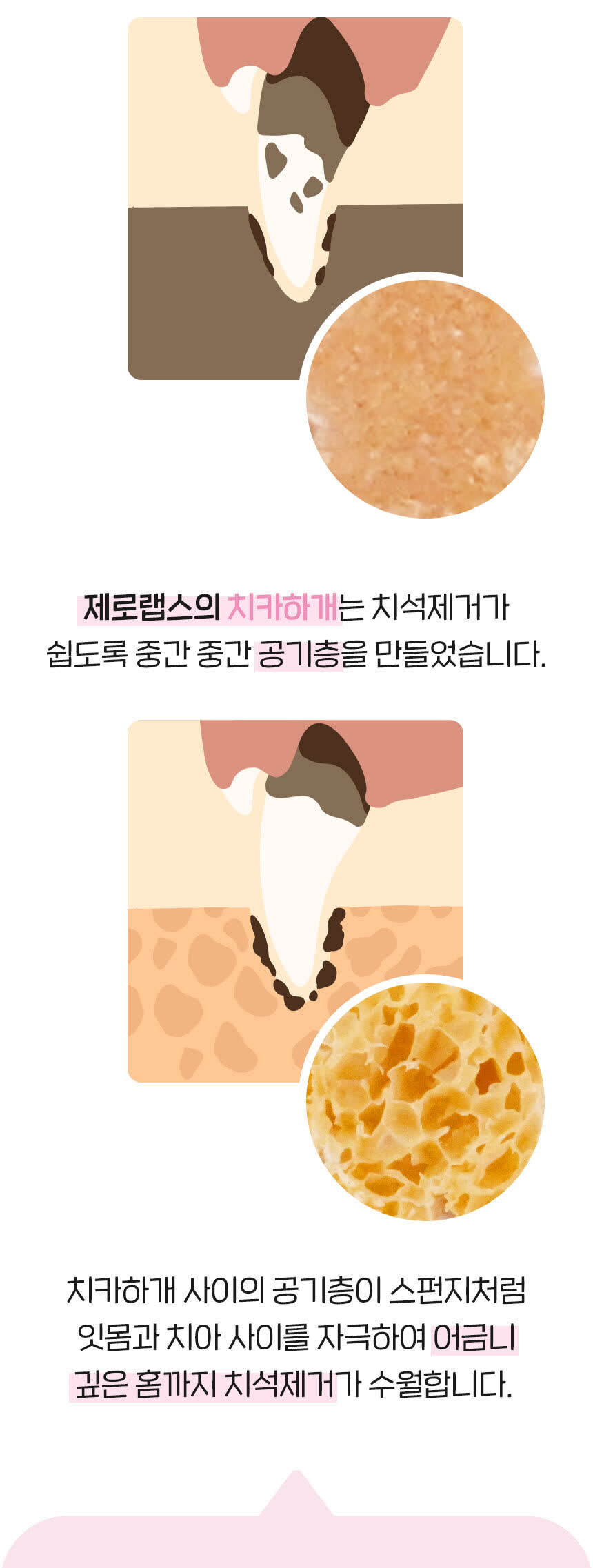 상세